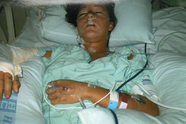 Megan in the hospital following her motorcycle accident